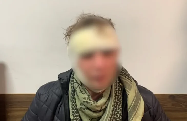 Під Києвом чоловіка побили трубою по голові у власному будинку