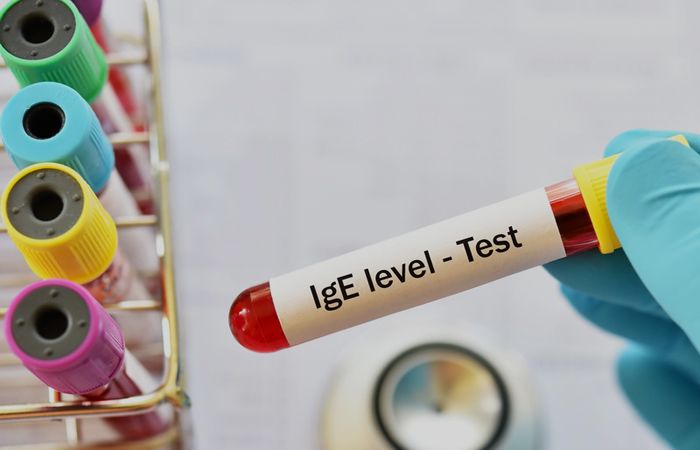Робимо аналіз на імуноглобуліни Е (IgE) – головний маркер алергії