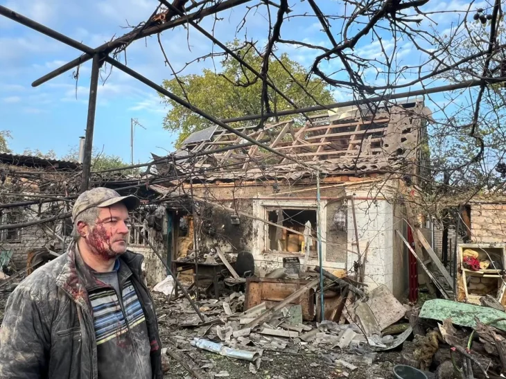 У Херсоні внаслідок обстрілу рф поранено підлітка та кількох містян